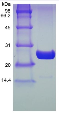 SDS-PAGE (UBE2K-208H).jpg